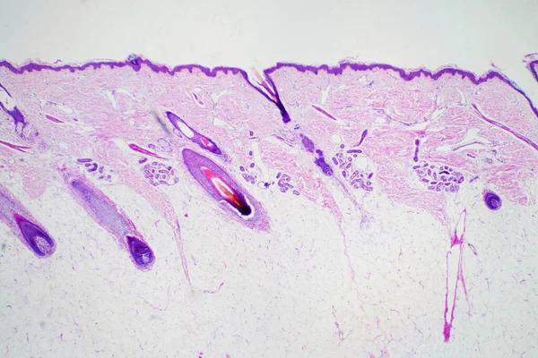 Průřez Lidské Kůže Hlavy Pod Mikroskopem Pohled Pro Vzdělávání Histologie — Stock fotografie