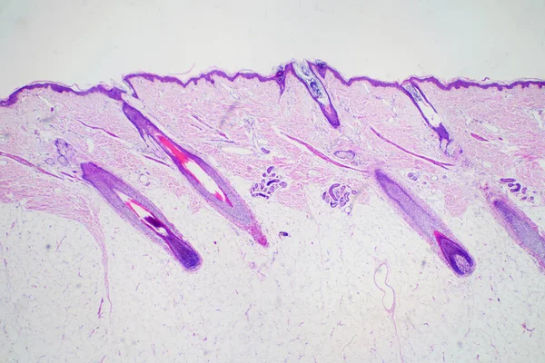 教育組織学のための顕微鏡視野の下で断面ヒト皮膚頭 人間の生理学の歴史 — ストック写真