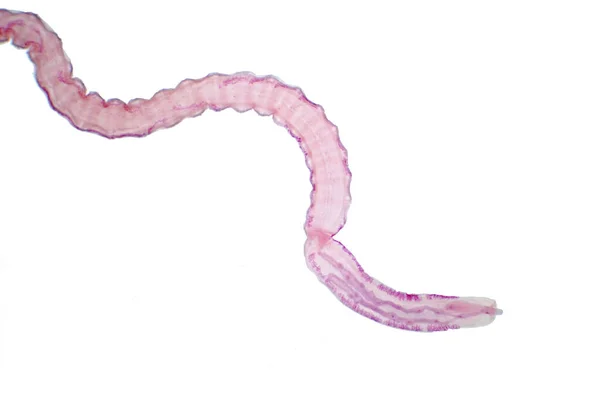 Tapeworm Verme Piatto Parassitario Bovini Altri Animali Pascolo Microscopio Istruzione — Foto Stock
