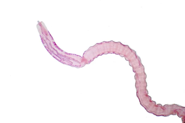 Σκουληκάκι Parasitic Flatworm Βοοειδών Και Άλλων Χορτοφάγων Ζώων Στο Μικροσκόπιο — Φωτογραφία Αρχείου