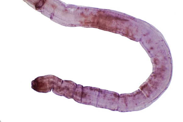 Tapeworm Verme Piatto Parassitario Bovini Altri Animali Pascolo Microscopio Istruzione — Foto Stock