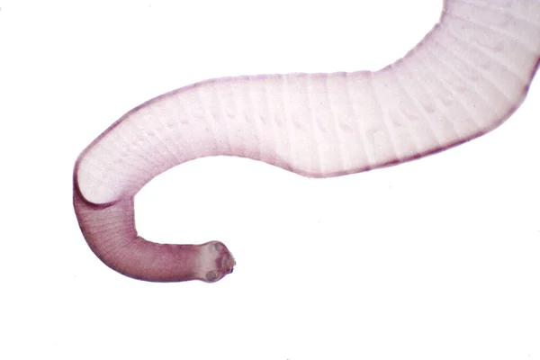 Tapeworm Pasożytniczy Bydła Innych Zwierząt Wypasanych Pod Mikroskopem Celach Edukacyjnych — Zdjęcie stockowe