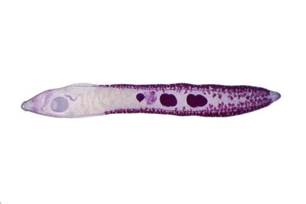 Συκώτι Parasitic Flatworm Βοοειδών Και Άλλων Χορτοφάγων Ζώων Στο Μικροσκόπιο — Φωτογραφία Αρχείου