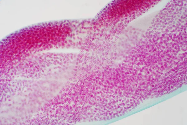 Microscopisch Beeld Van Eitjesparasiet Toxocara Canis Onder Microscoop Voor Onderwijs — Stockfoto