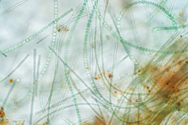 Anabaena mikroskobik altında yaşayan bir alg türüdür..