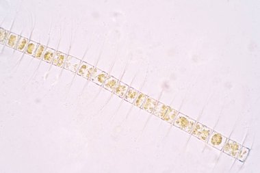 Chaetoceros deniz planktonik diatomlarının en büyük cinsidir.