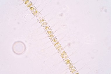Chaetoceros is the largest genus of marine planktonic diatoms, phytoplankton clipart