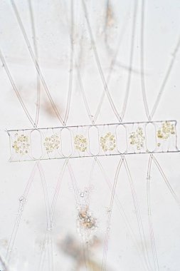 Chaetoceros deniz planktonik diatomlarının en büyük cinsidir.