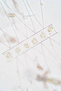 Chaetoceros deniz planktonik diatomlarının en büyük cinsidir.