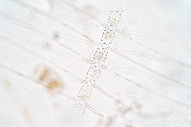 Chaetoceros deniz planktonik diatomlarının en büyük cinsidir.