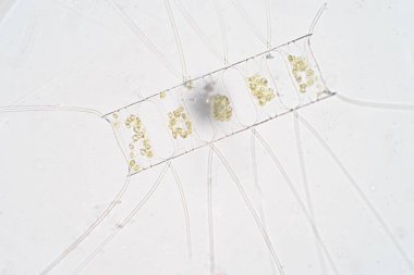 Chaetoceros deniz planktonik diatomlarının en büyük cinsidir.