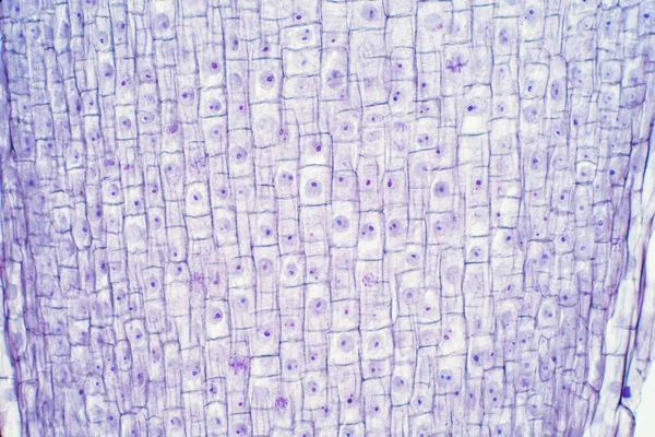 Ρίζα Άκρη Του Κυττάρου Κρεμμύδι Και Μίτωση Στο Ρίζα Άκρη — Φωτογραφία Αρχείου