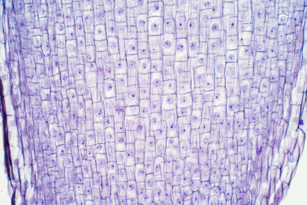 Root tip of Onion and Mitosis cell in the Root tip for education