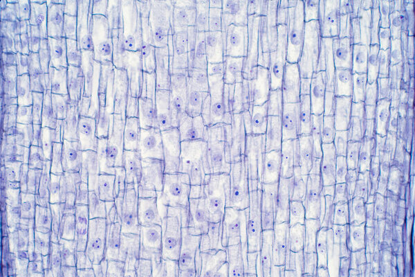 Root tip of Onion and Mitosis cell in the Root tip for education.