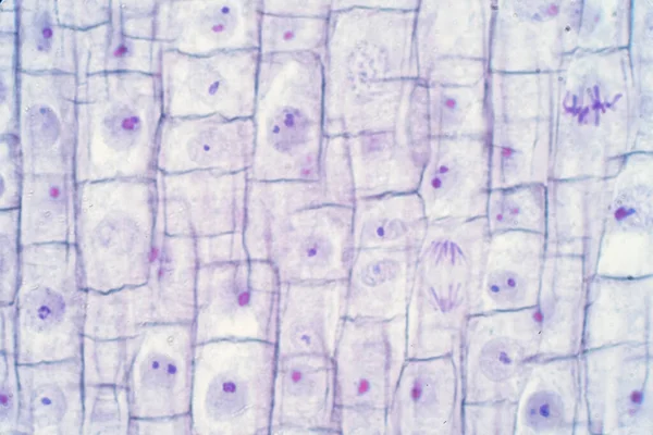 Špička Kořenové Buňky Cibule Mitózy Kořeni Pro Výuku — Stock fotografie