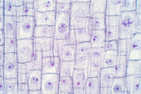 教育用根尖中洋葱和有丝分裂细胞的根尖 — 图库照片