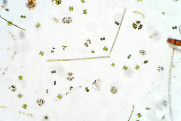 Прісноводний Водний Планктон Під Мікроскопом Лабораторії — стокове фото
