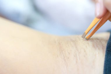 Koltuk altı kıllarını aldıran kadının elini kapat. Güzellik bakımı.