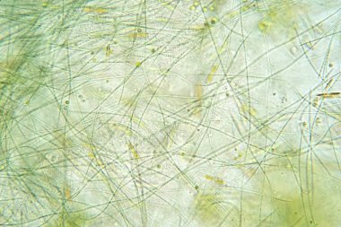 Filamentöz algler, uzun görünen zincirler, iplikler veya lifler oluşturan tek alg hücreleridir..