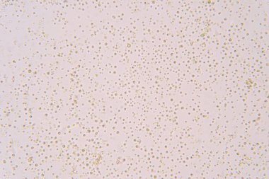 Chlorella, Klorofil takımına ait tek hücreli yeşil alg cinsidir..