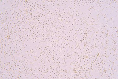 Chlorella, Klorofil takımına ait tek hücreli yeşil alg cinsidir..