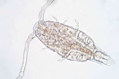 Kopepod (Zooplankton), deniz ve tatlı su habitatlarında bulunan küçük bir kabuklulardır..