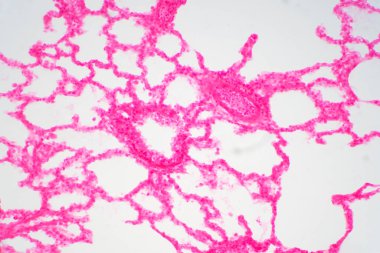 Mikroskop altında insan akciğer dokusu. Akciğerler, insanlarda ve diğer hayvanlarda solunum sisteminin birincil organlarıdır.