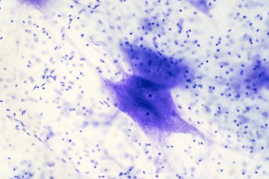 Eğitim için mikroskop altında beyindeki nöron hücreleri.