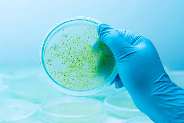 Колонія Синьо Зелених Водоростей Культурі Середньої Пластини Мікробіологія — стокове фото