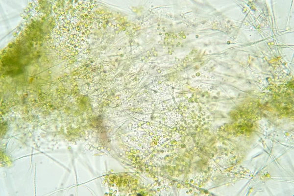 Filamentous algae are single algae cells that form long visible chains, threads, or filaments.