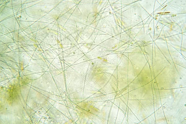 Algas Filamentosas São Células Algas Únicas Que Formam Longas Cadeias — Fotografia de Stock