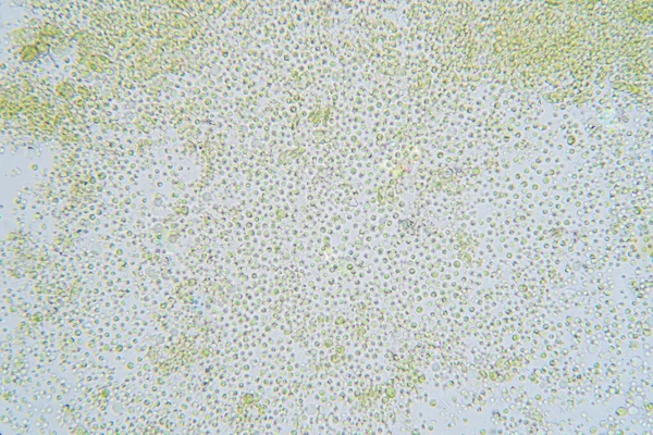 Хлорелла Рід Одноклітинних Зелених Водоростей Належать Поділу Chlorophyta — стокове фото