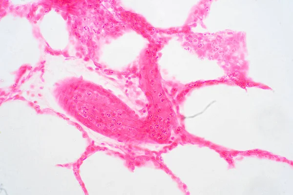 Tecido Pulmonar Humano Sob Visão Microscópica Pulmões São Órgãos Primários — Fotografia de Stock