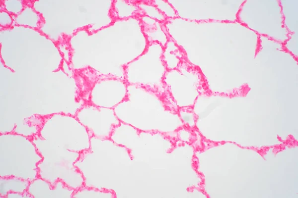 Ткани Легких Человека Микроскопом Легкие Являются Основными Органами Дыхательной Системы — стоковое фото