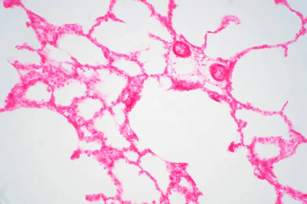 Tecido Pulmonar Humano Sob Visão Microscópica Pulmões São Órgãos Primários — Fotografia de Stock