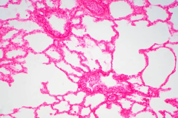 Ludzka Tkanka Płucna Pod Mikroskopem Płuca Głównymi Narządami Układu Oddechowego — Zdjęcie stockowe