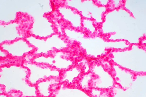 현미경으로 사람의 폐조직이다 인간과 흡기계의 기관이다 — 스톡 사진
