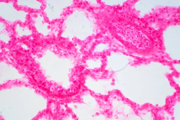 Menselijk Longweefsel Onder Microscoop Longen Zijn Primaire Organen Van Het — Stockfoto