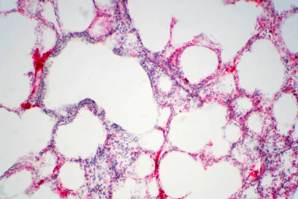 Human Lung Tissue Microscope View Lungs Primary Organs Respiratory System — Stock Photo, Image