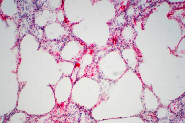 Tecido Pulmonar Humano Sob Visão Microscópica Pulmões São Órgãos Primários — Fotografia de Stock