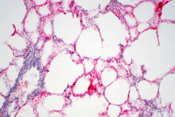 Tejido Pulmonar Humano Bajo Vista Microscopio Los Pulmones Son Los —  Fotos de Stock