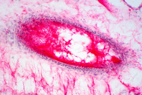 Ludzka Tkanka Płucna Pod Mikroskopem Płuca Głównymi Narządami Układu Oddechowego — Zdjęcie stockowe