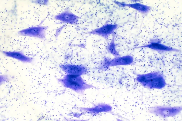 Neuronen Cellen Uit Hersenen Onder Microscoop Voor Onderwijs — Stockfoto