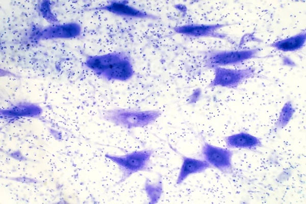 Neuronen Cellen Uit Hersenen Onder Microscoop Voor Onderwijs — Stockfoto