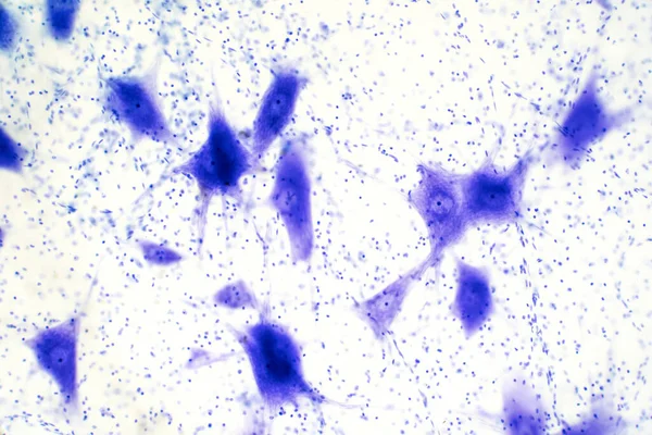 Клітини Нейронів Мозку Під Мікроскопом Навчання — стокове фото