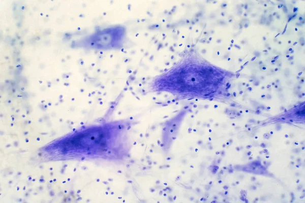 Cellule Neuronali Dal Cervello Microscopio Vista Educazione — Foto Stock