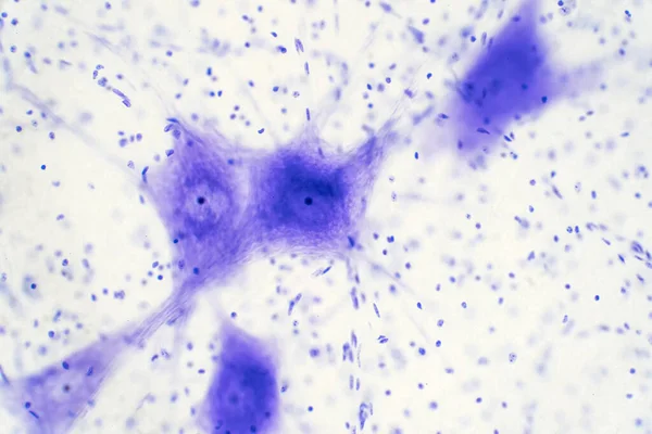 显微镜下脑内神经细胞的培养 — 图库照片