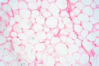 Fizyoloji eğitimi için insan yağı dokusu mikroskop altında.