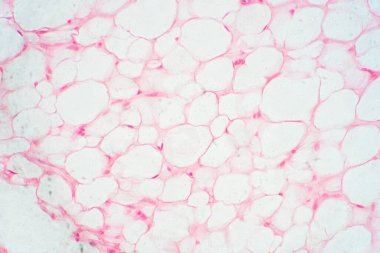 Fizyoloji eğitimi için insan yağı dokusu mikroskop altında.