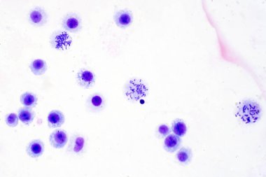 Eğitim için mikroskop altında kandan insan kromozomları.